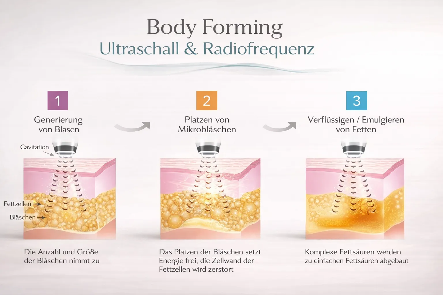 How does cavitation work?