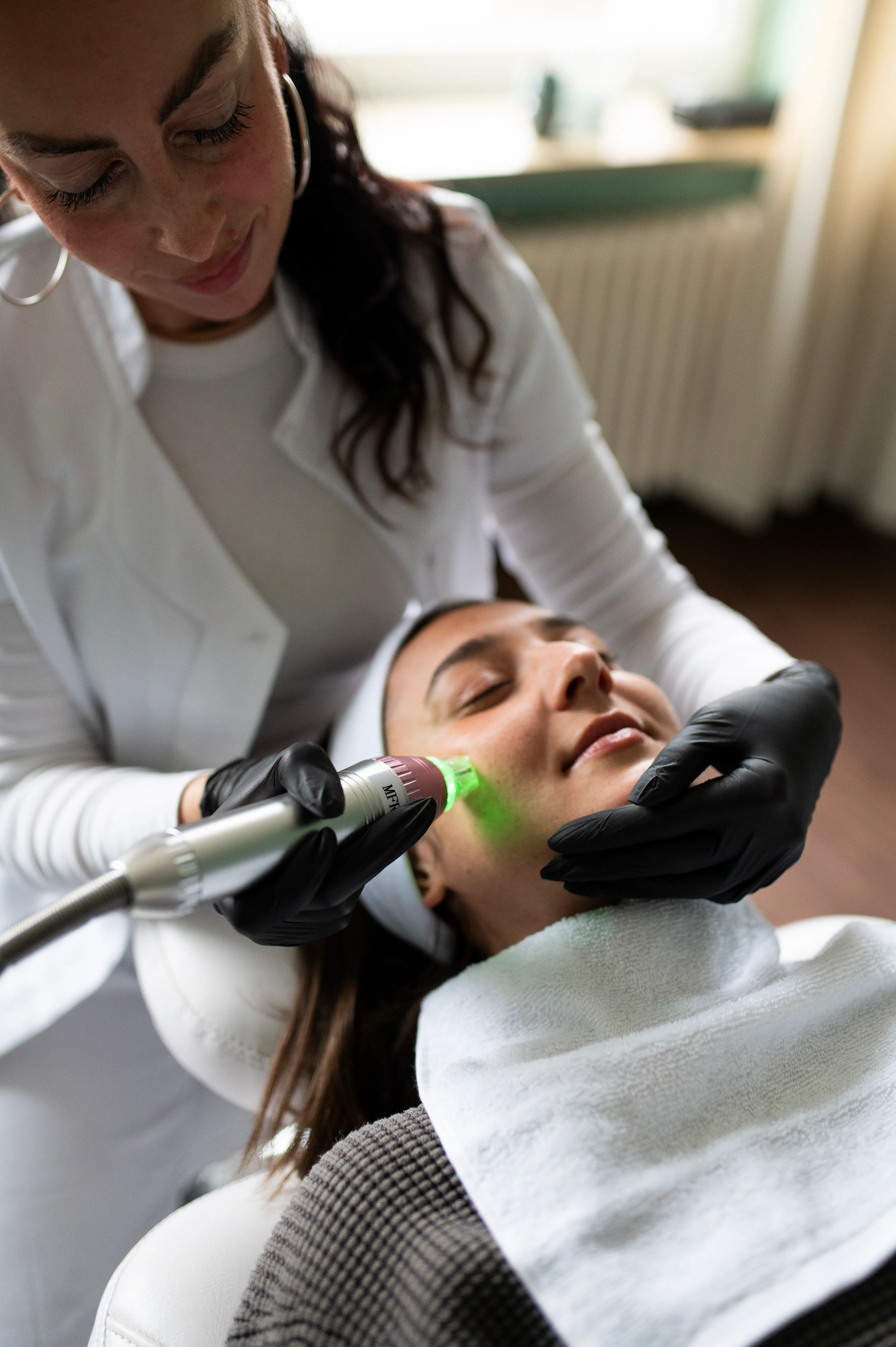 What is radiofrequency microneedling?